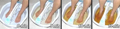 Ionic Foot Bath